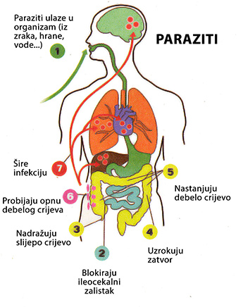 paraziti